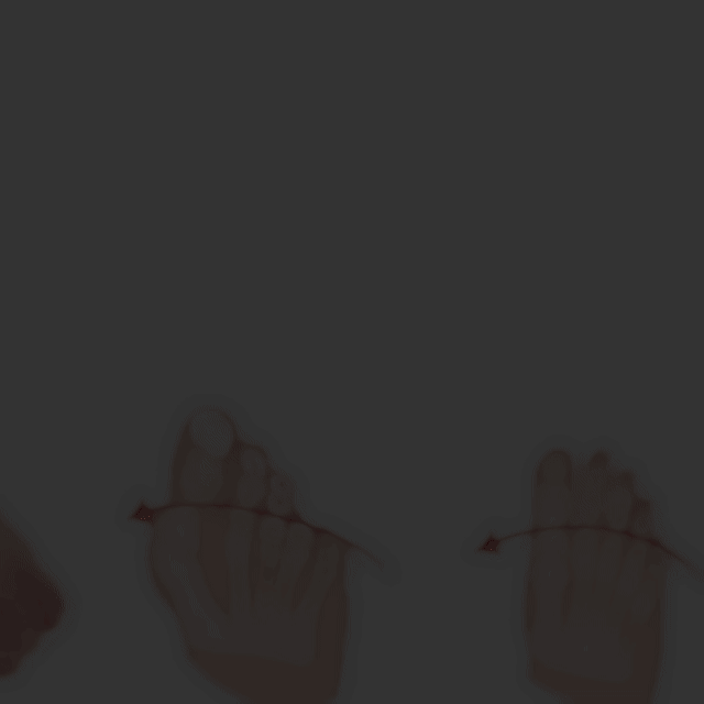 Gel Separador Juanete